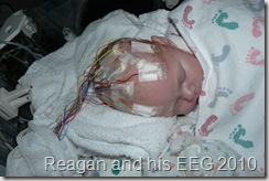 EEG on my son