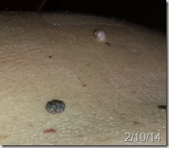 Moles that have to go. 2/10/14